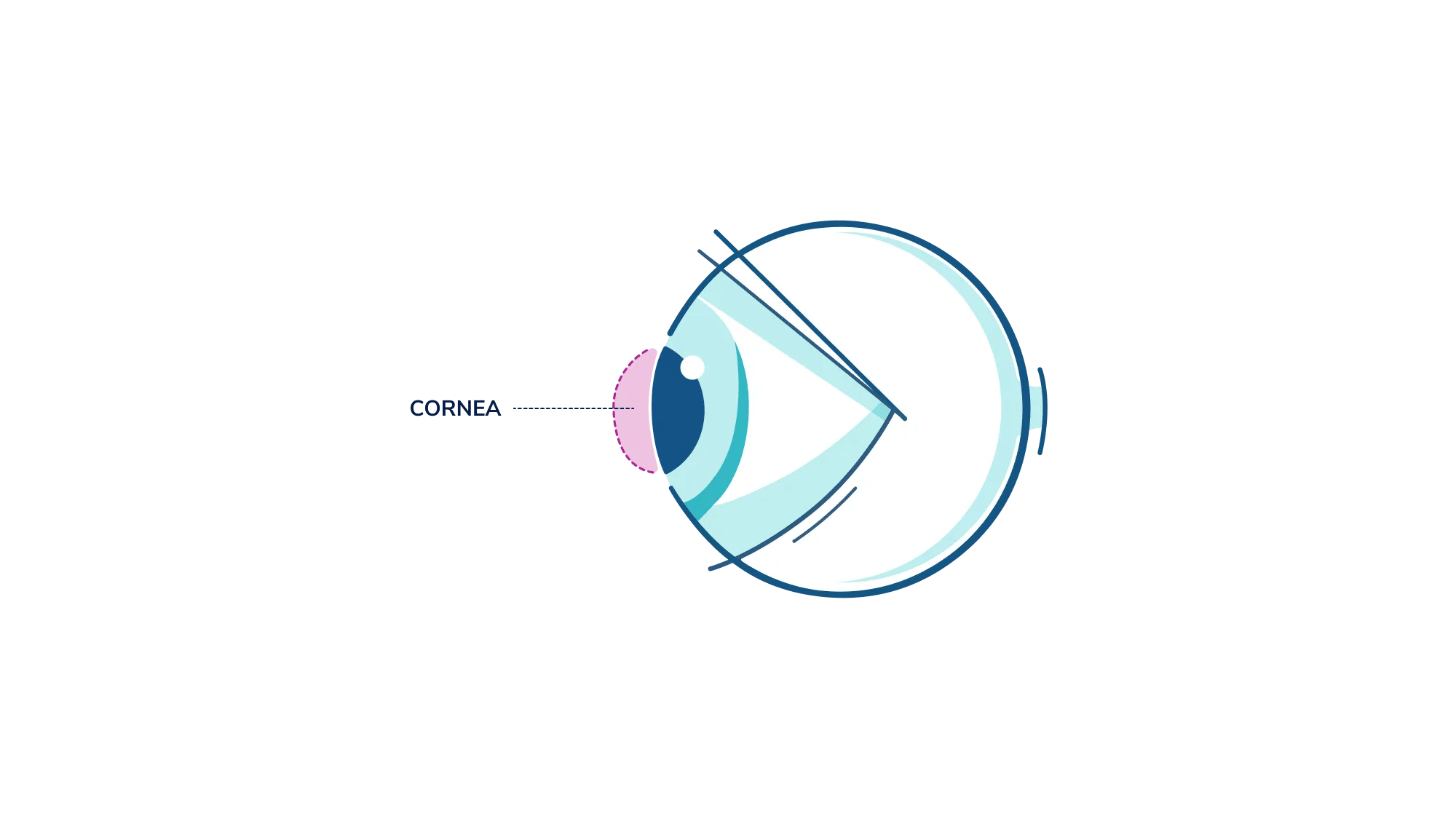 An illustration showing where the cornea is in the eye.