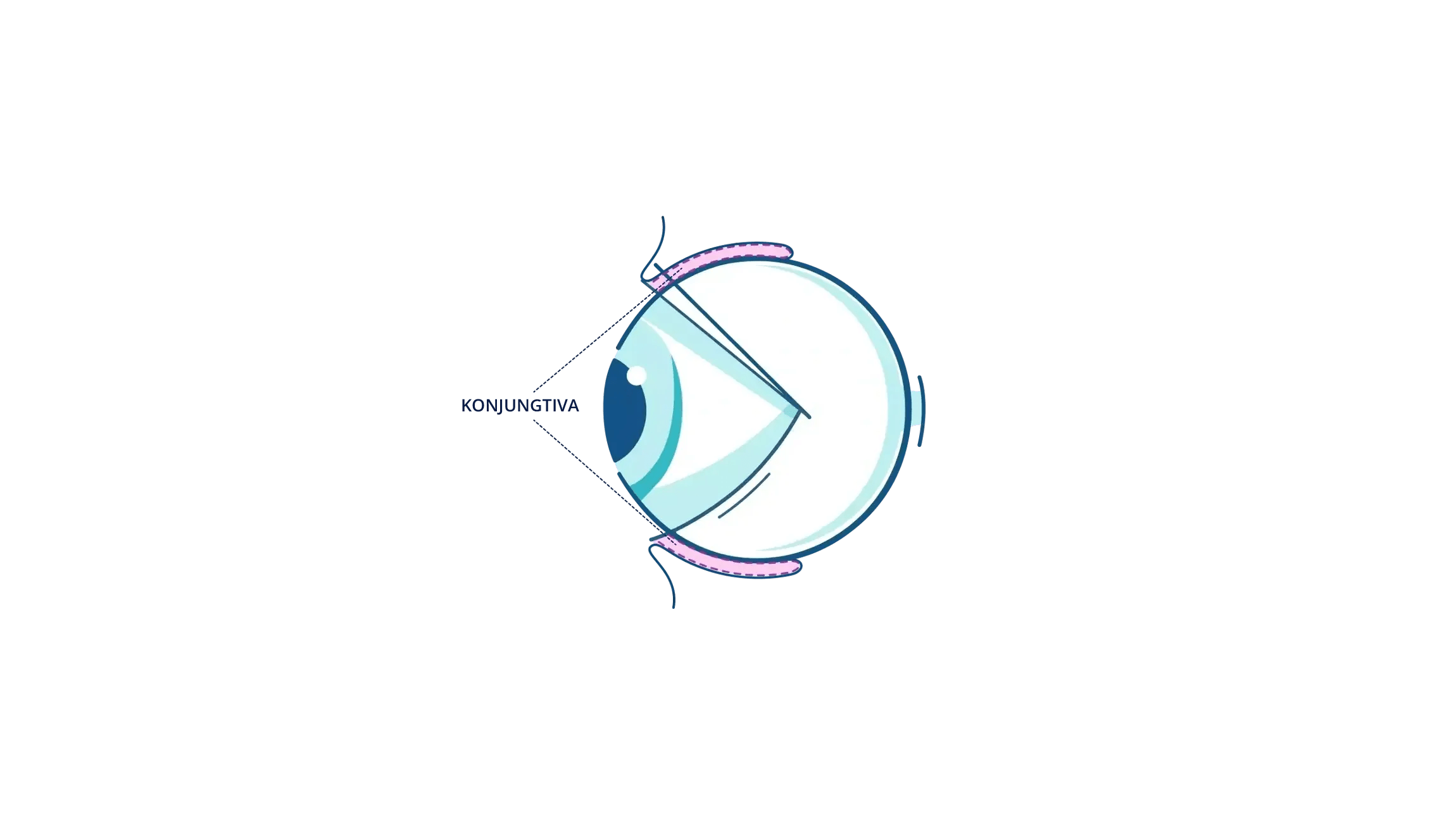 An illustration showing where the conjunctiva is in the eye.