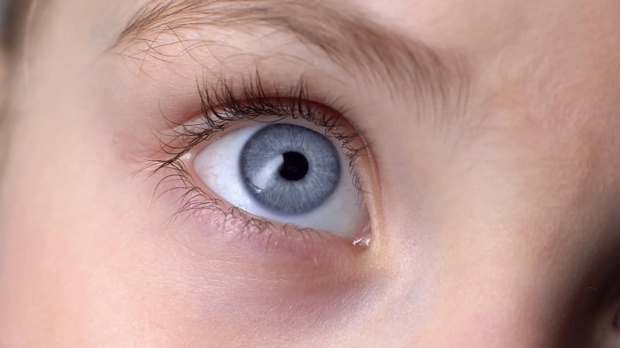 Close up of a child's blue eye looking up, with a reddish eyebrow visible