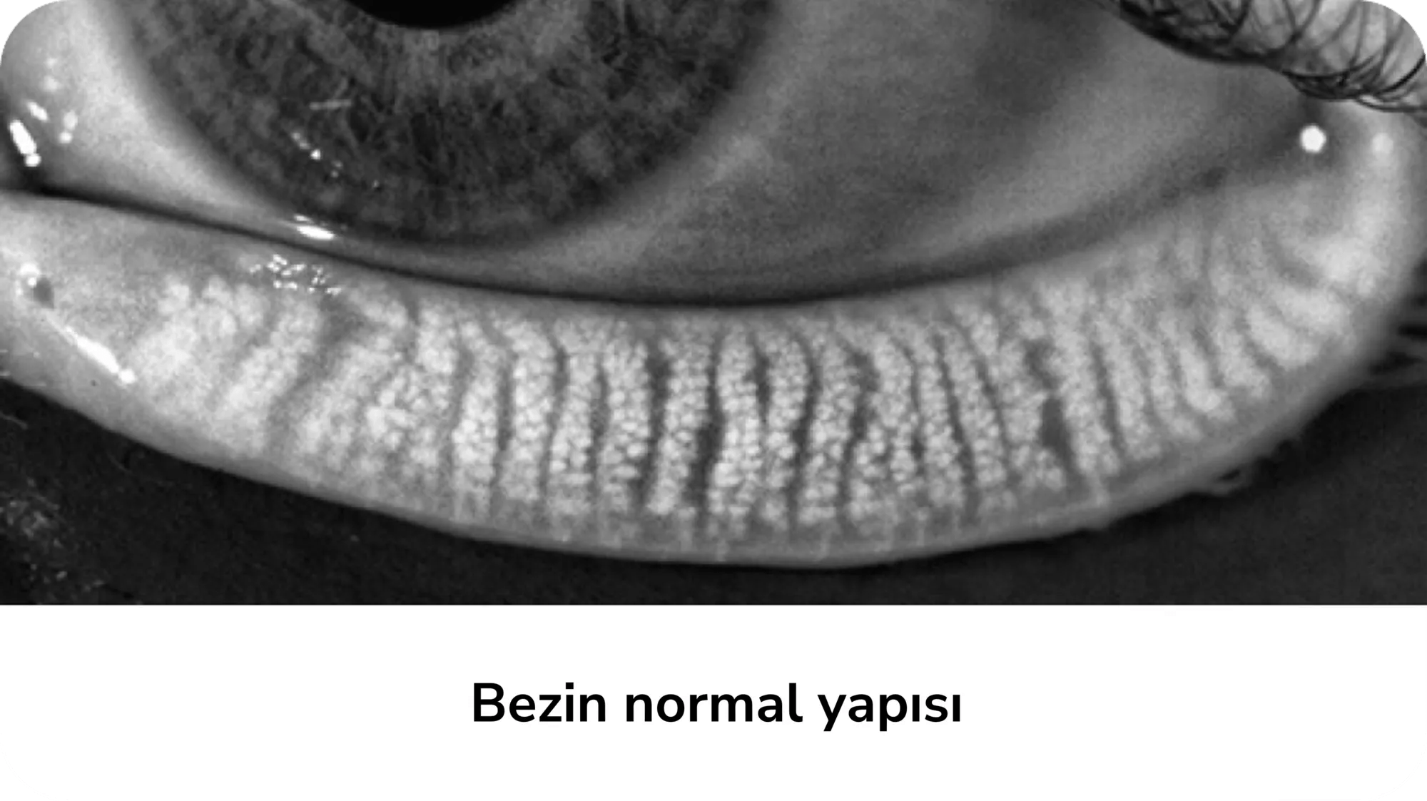 Bezin normal yapısı