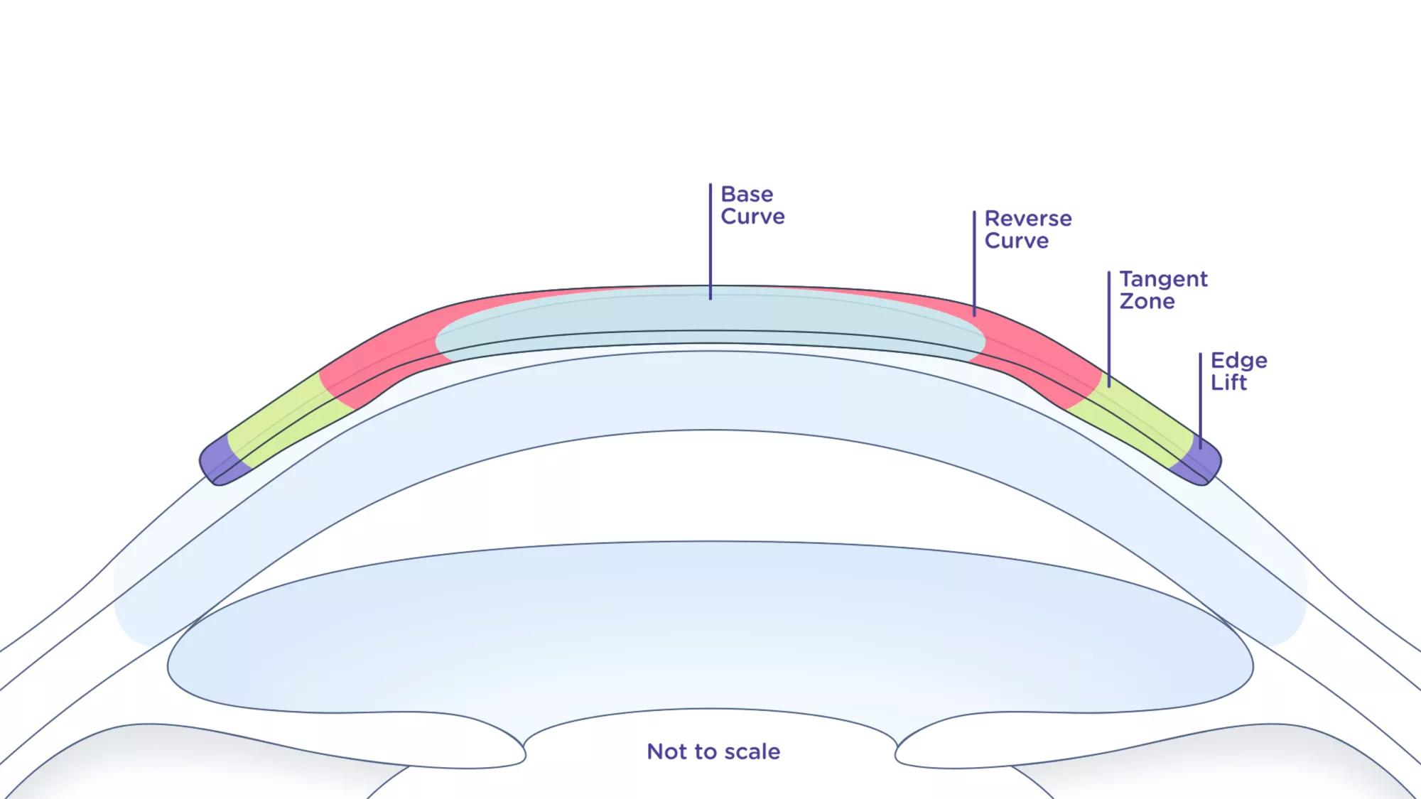 Abiliti Eye Diagram - Not to Scale