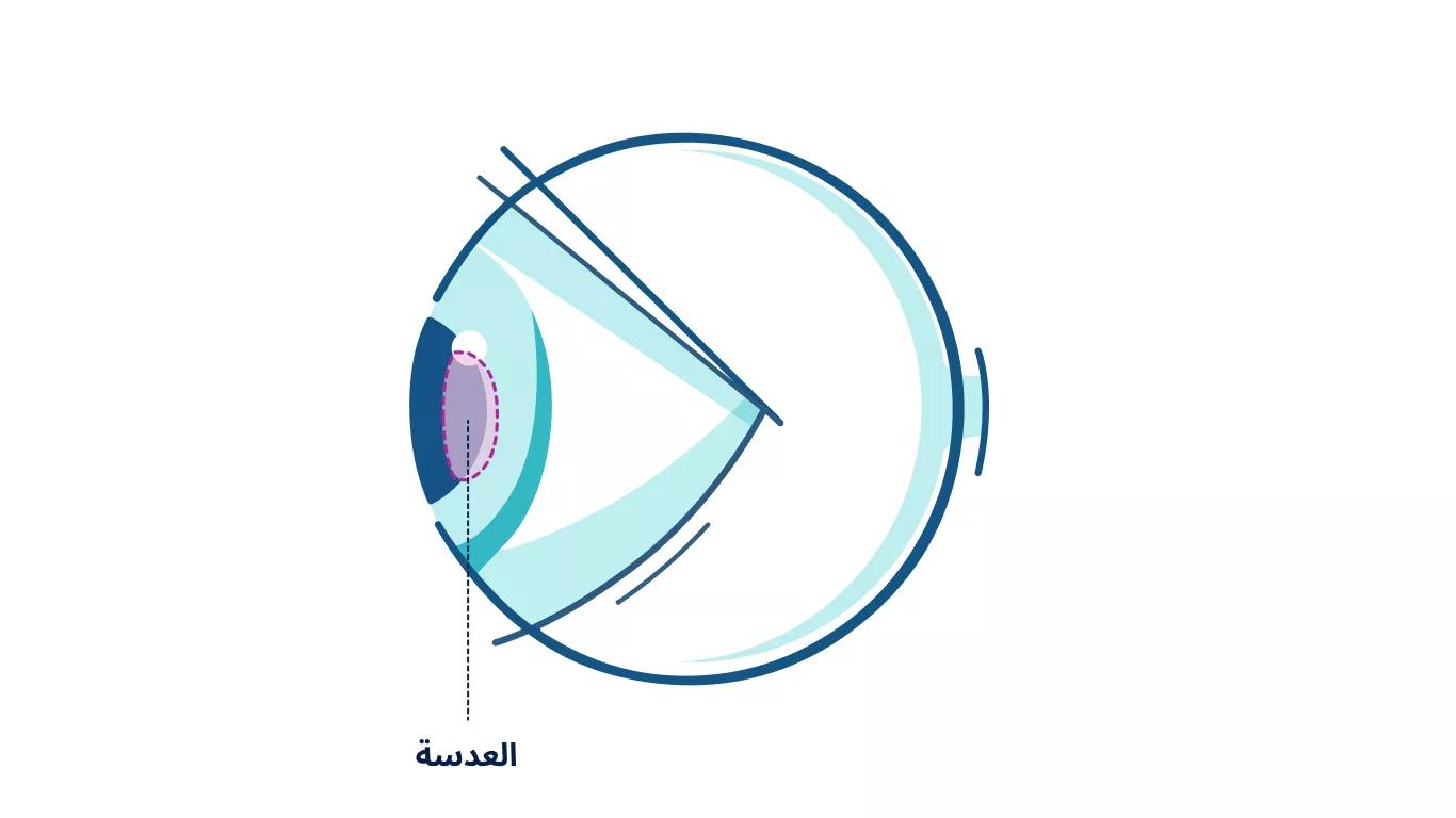رسم توضيحي لأي عين مع تسليط الضوء على العدسة