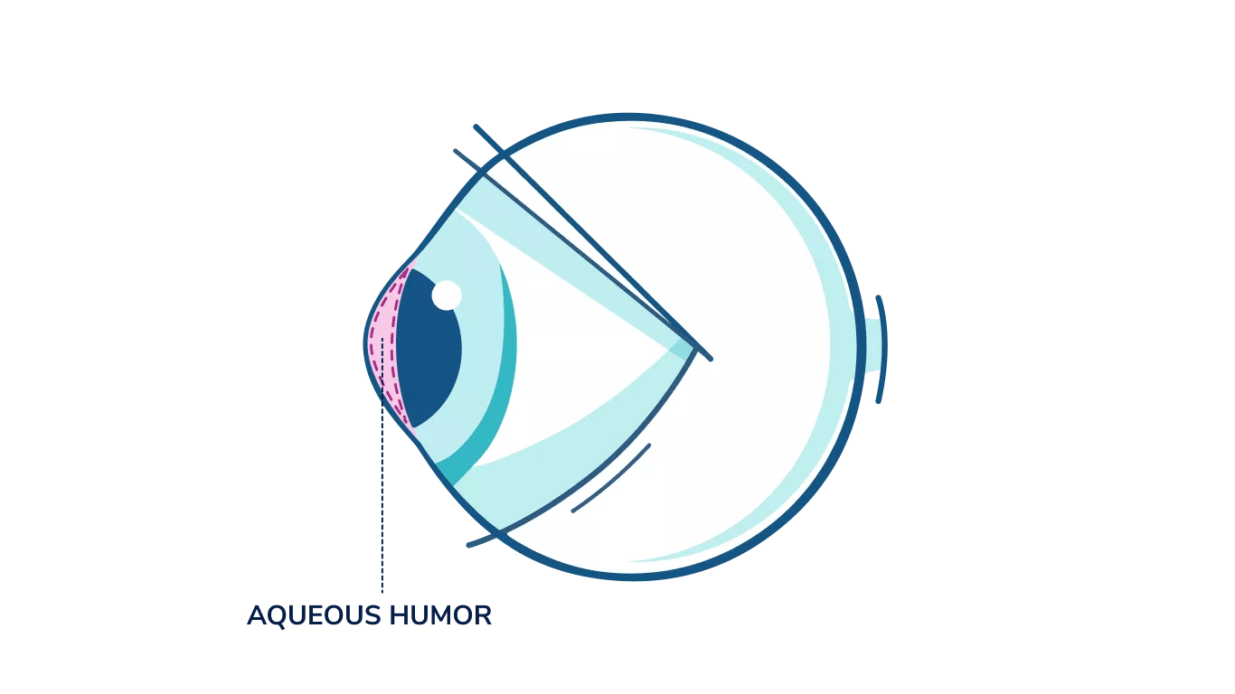 An illustration showing where the aqueous humor is in the eye.