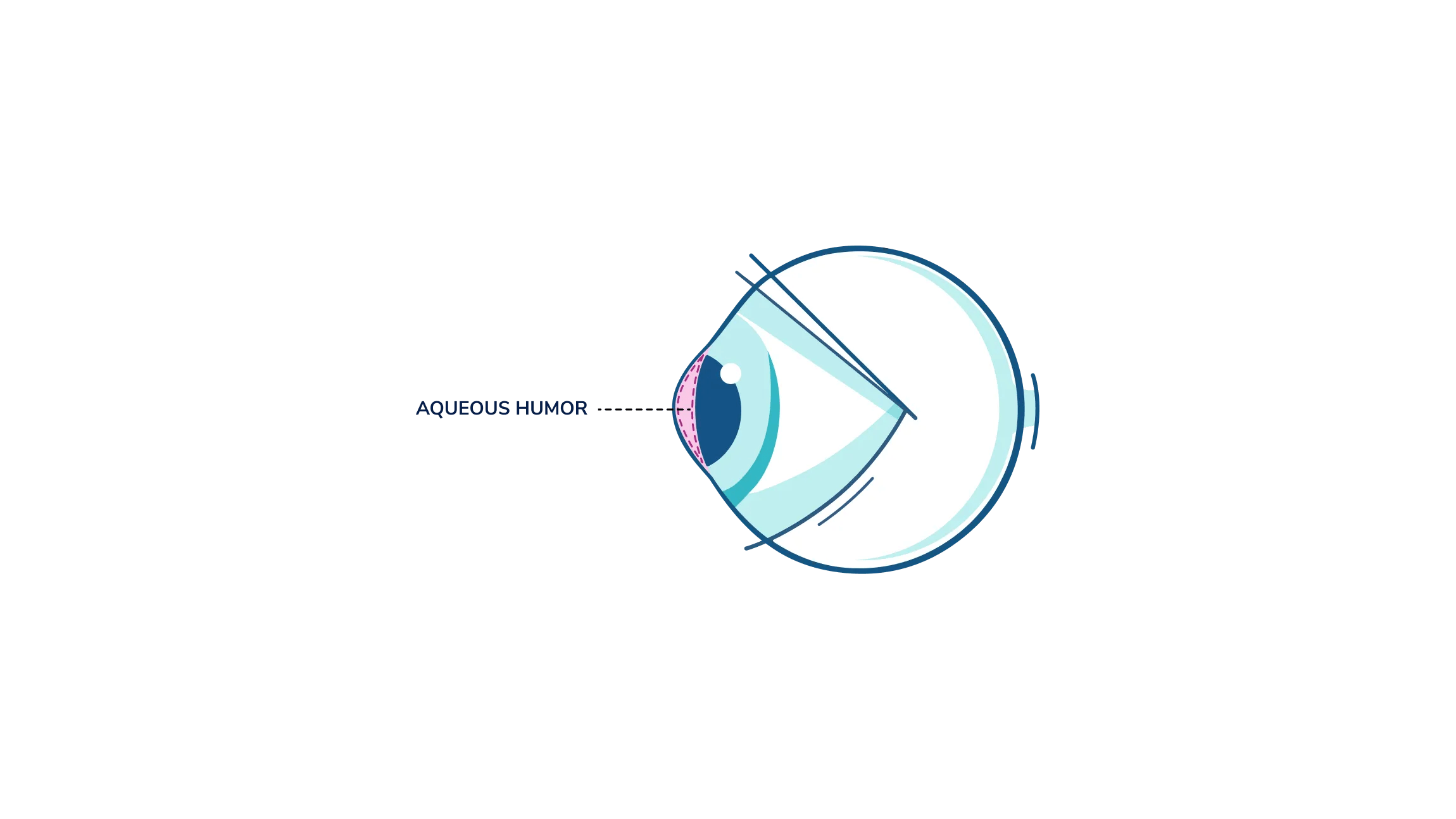 An illustration showing where the aqueous humour is in the eye.