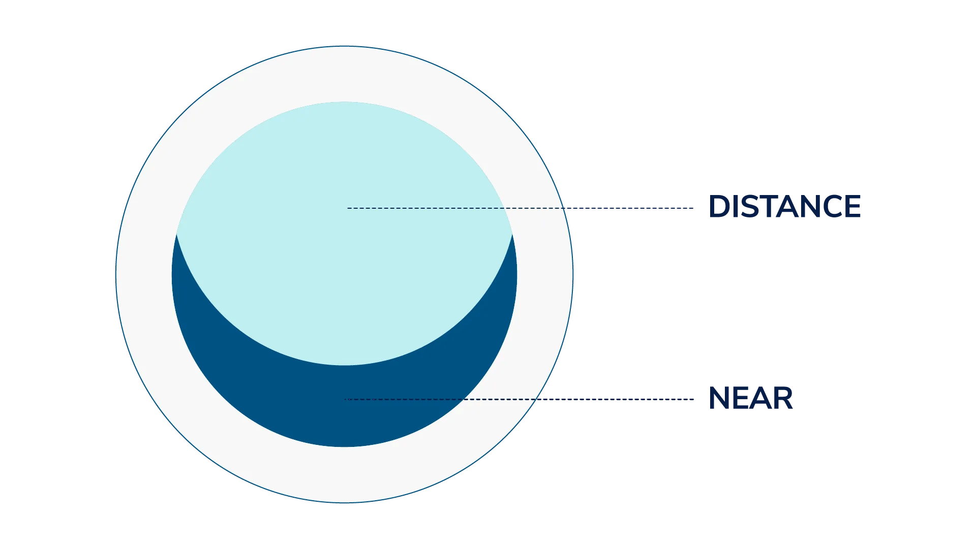  A simple illustration of a segmented multifocal lens that has near power at the bottom and distance at the top