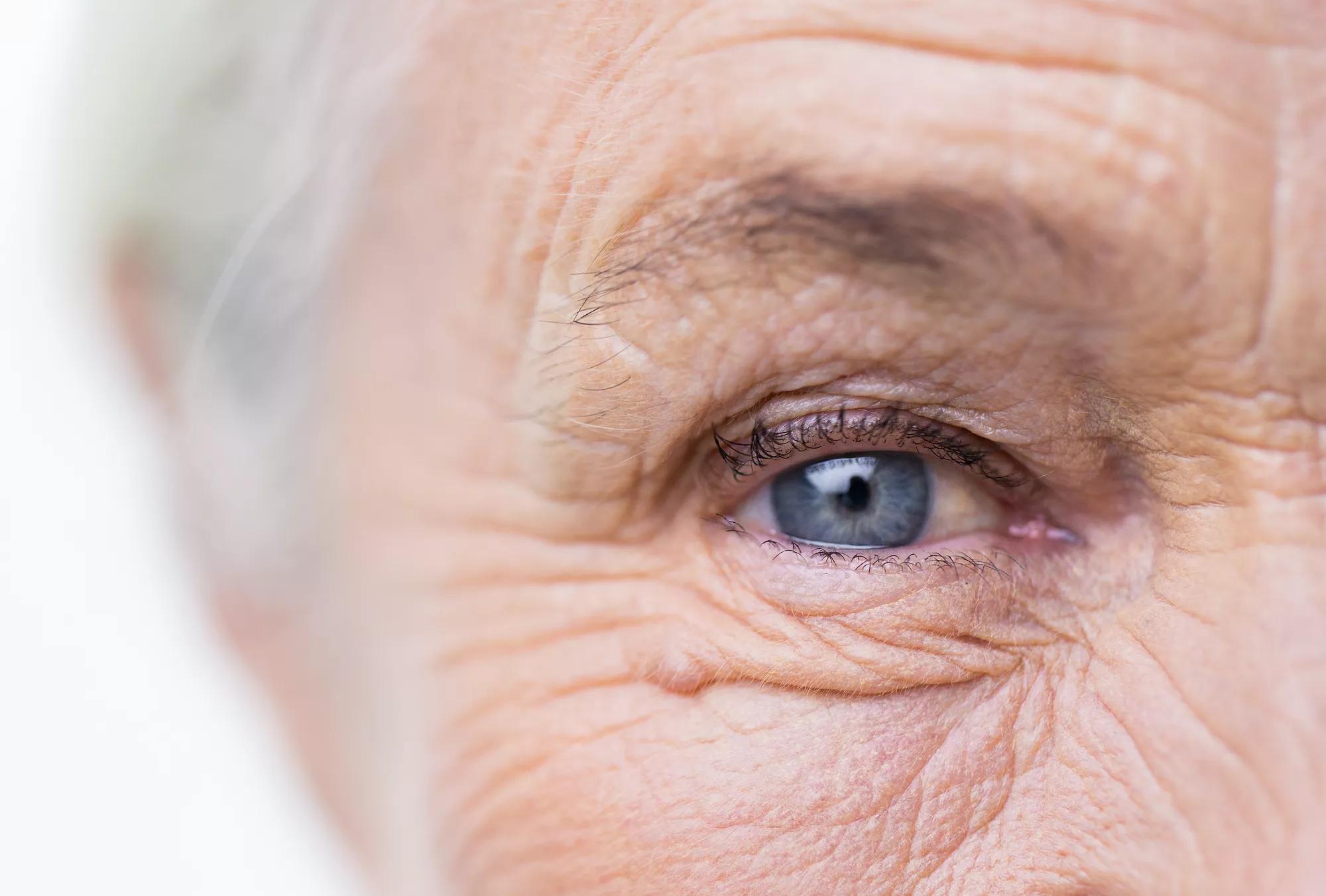 The eye of an elderly person looking straight ahead