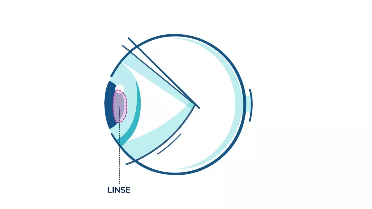 Illustrasjon av et øye som fremhever linsen