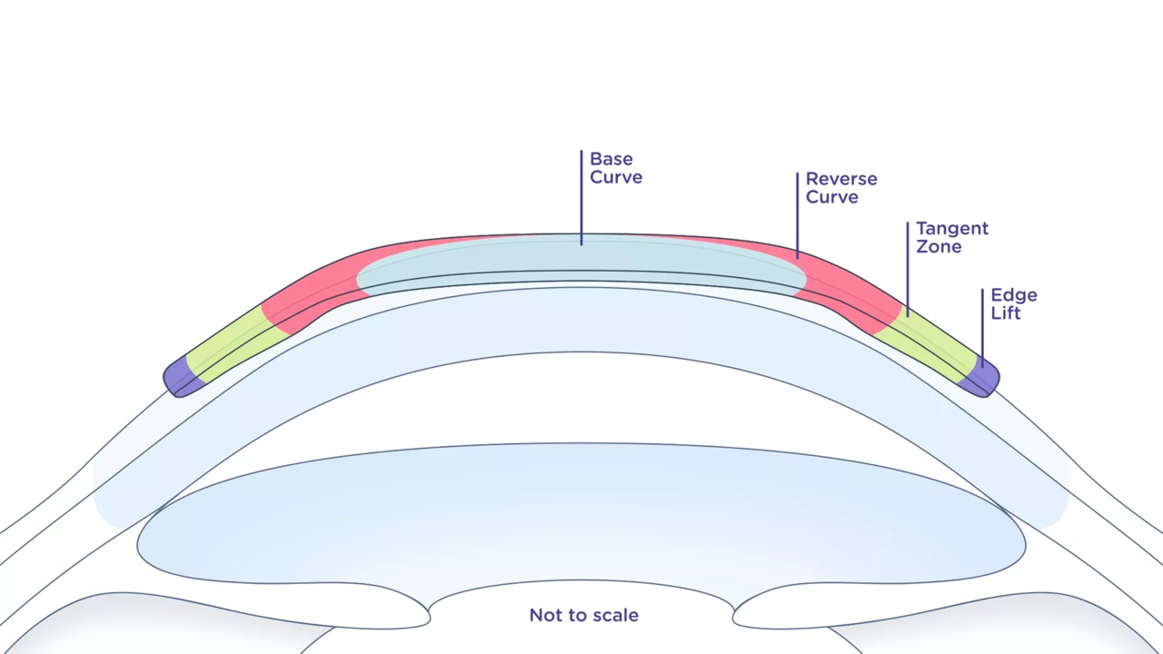 Abiliti Eye Diagram - Not to Scale