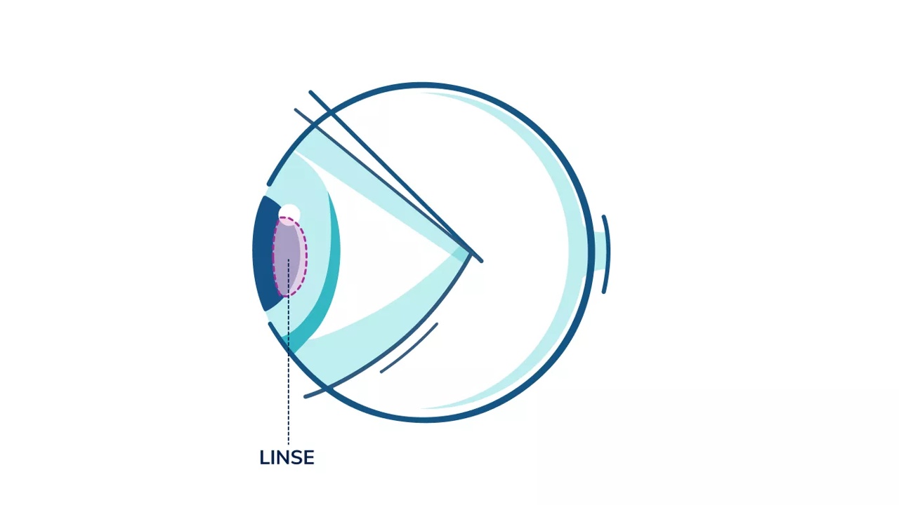 Illustration af et øje, der fremhæver linsen