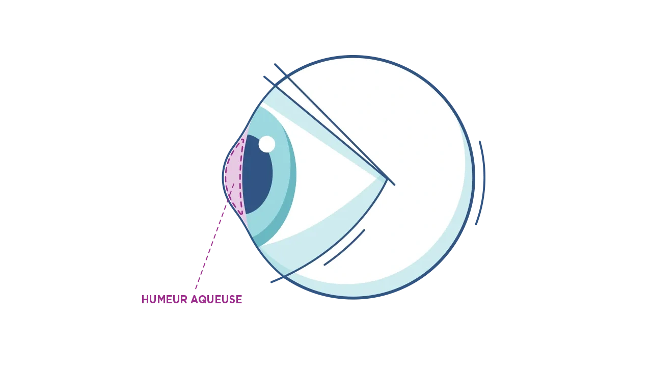 Illustration de l’humeur aqueuse et de l’humeur vitrée