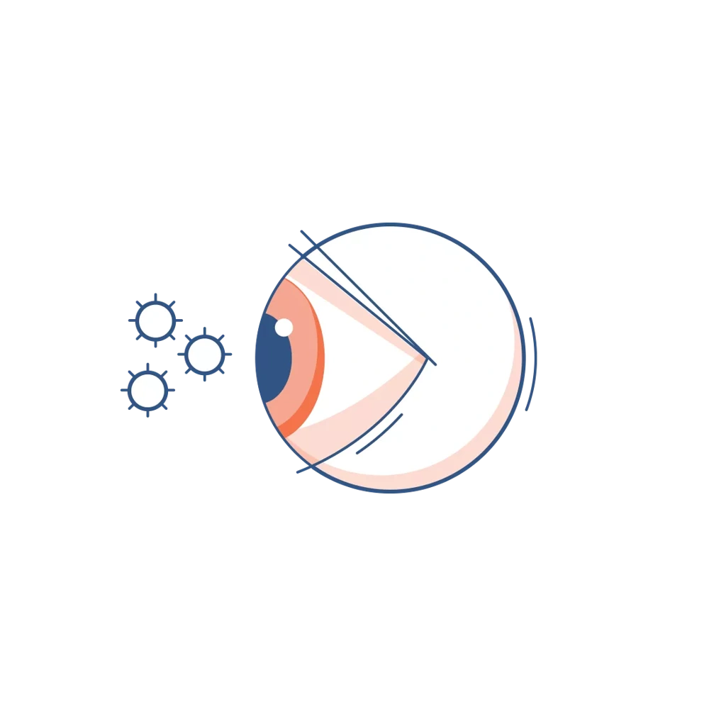 Icon of Eye Allergies