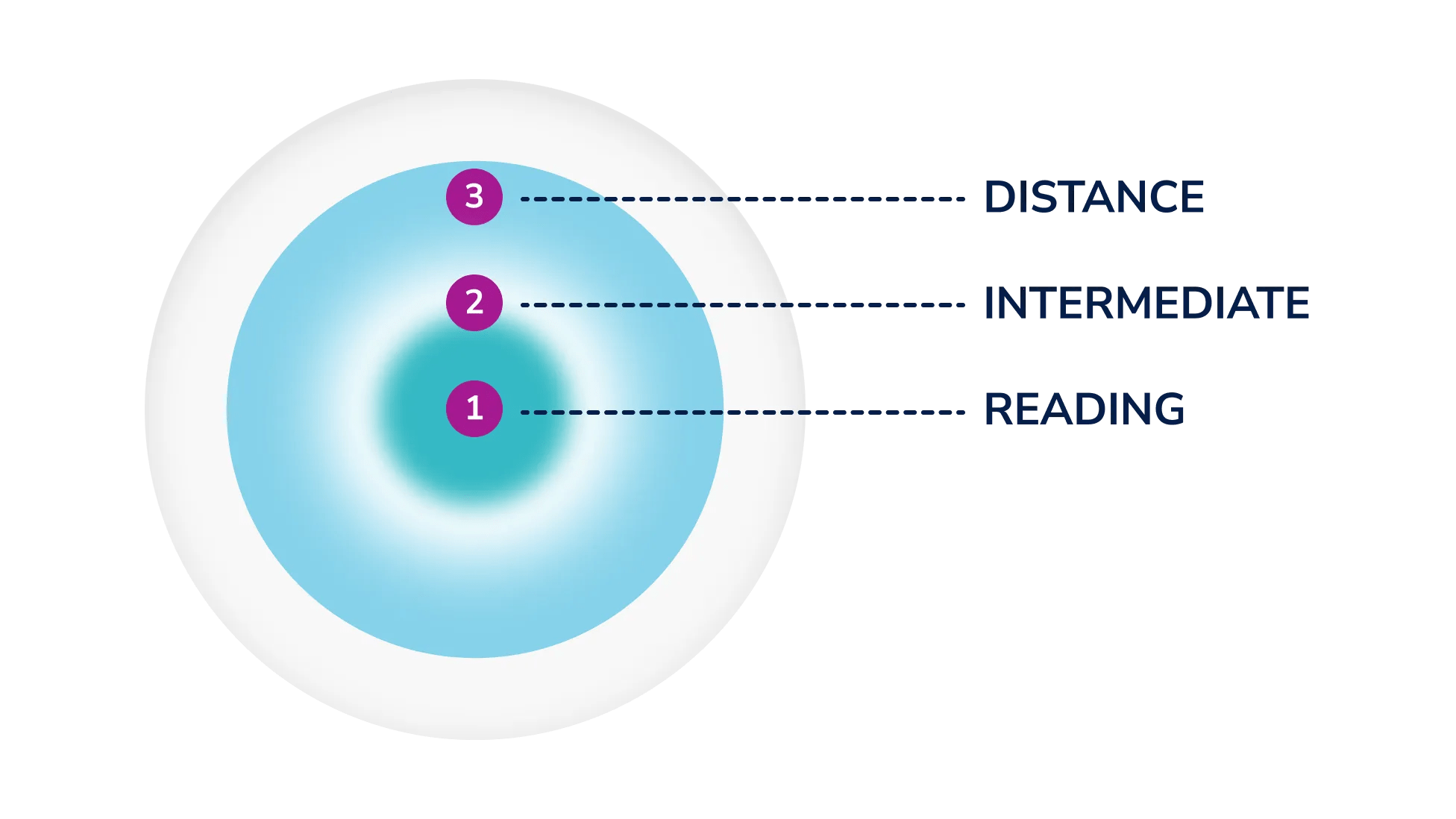 An illustration of the different powers in a multifocal lens shows distance, intermediate and reading, from the outside in.