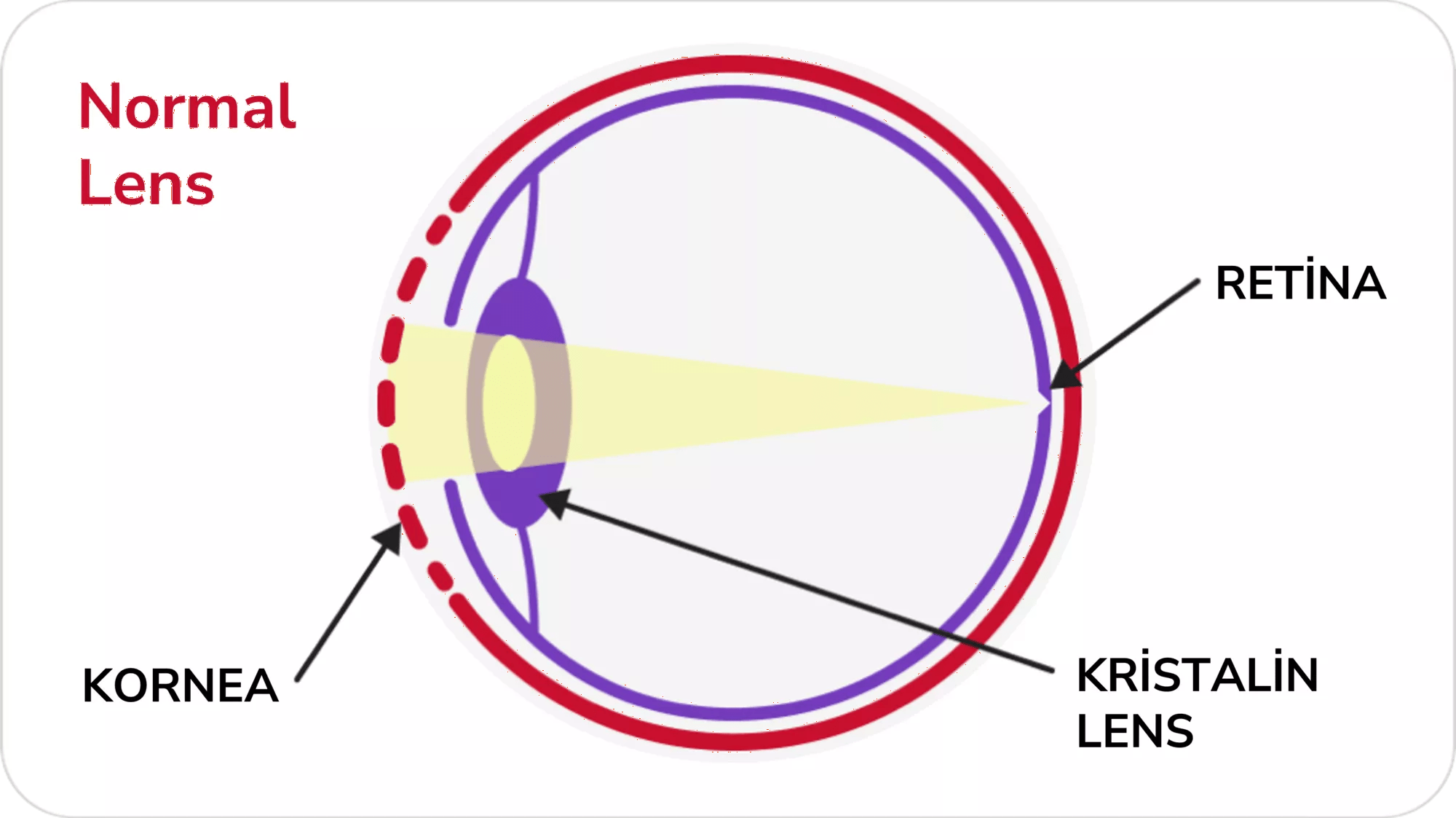 Normal lens