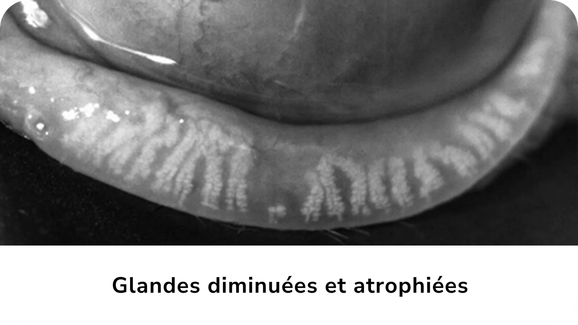 Glandes diminuées et atrophiées