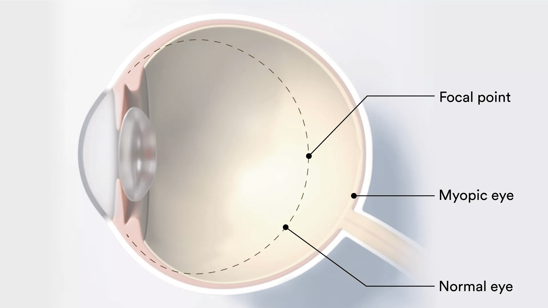 Eye diagram