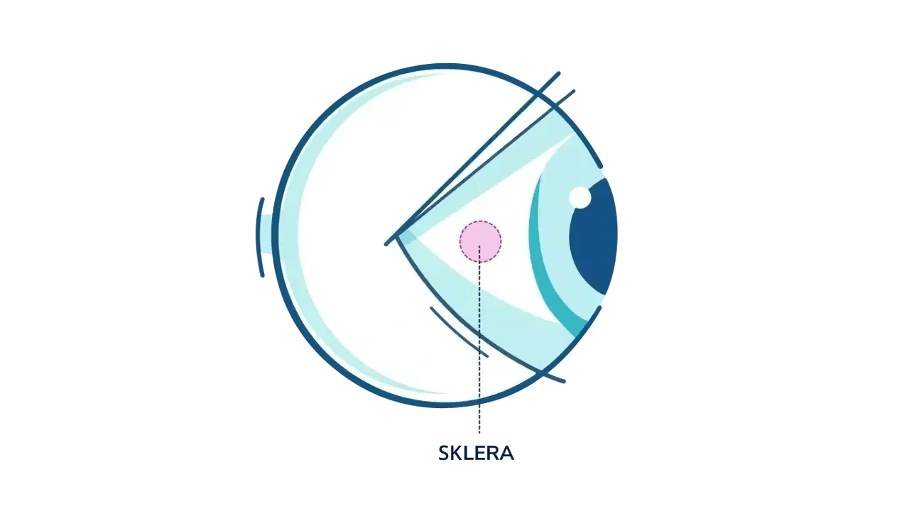 An illustration showing where the sclera is in the eye.