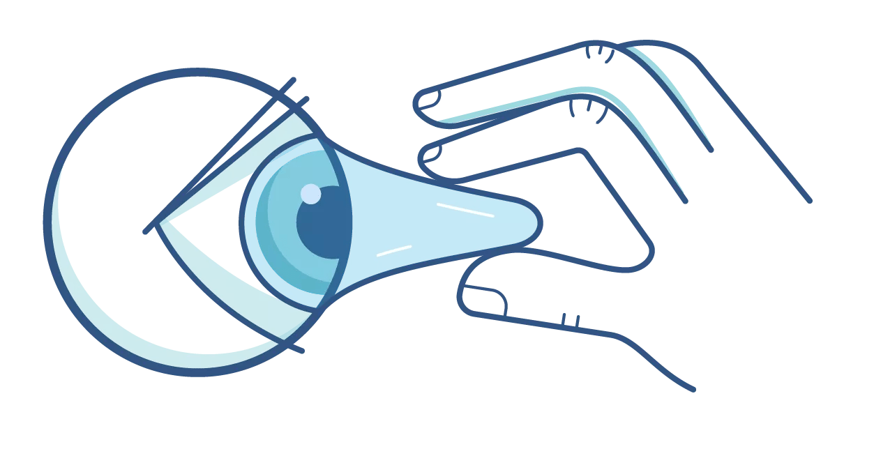 ACUVUE Illustration Myth Stuck in Eye Alt