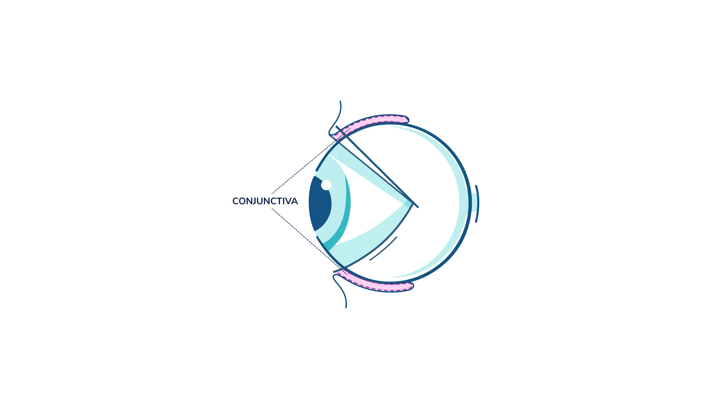 An illustration showing where the conjunctiva is in the eye.